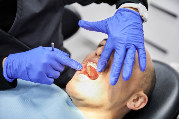 Best Dental Abscess Treatment in Beckley, WV